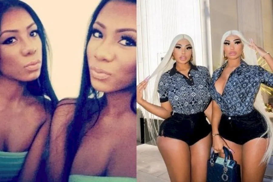 Clermont Twins Before And After 1