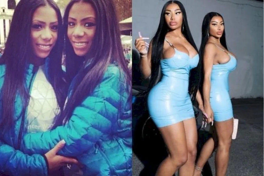 Clermont Twins Before And After 2